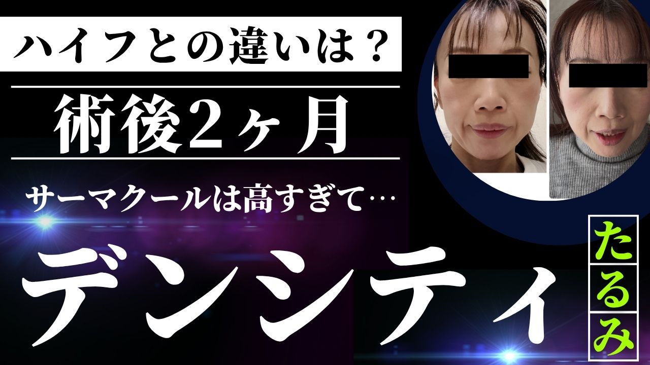 デンシティ術後2か月